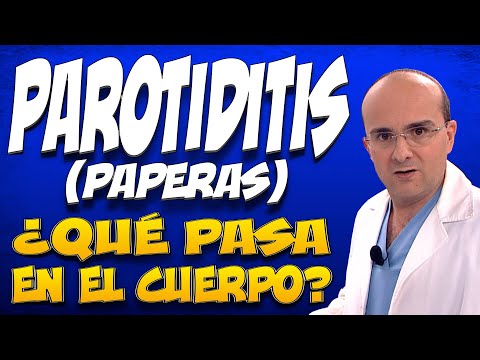 Estrategias tecnológicas para combatir el virus de parotiditis