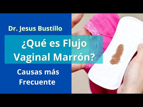 Flujo vaginal marrón: lo que tu cuerpo quiere decirte