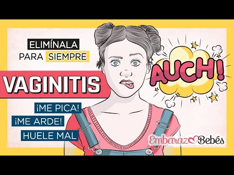 Soluciones efectivas para flujo amarillento y picazón
